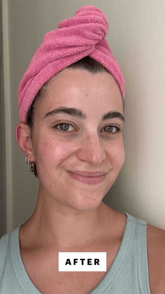 Felbin after applying the Glow Recipe Watermelon Glow AHA Night Treatment