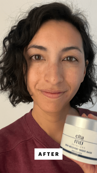 Pai after applying EltaMD Skin Recovery Night Mask